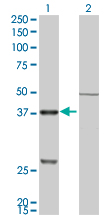 CTSK / Cathepsin K Antibody - Western blot of CTSK expression in transfected 293T cell line by CTSK monoclonal antibody, clone 2F1.