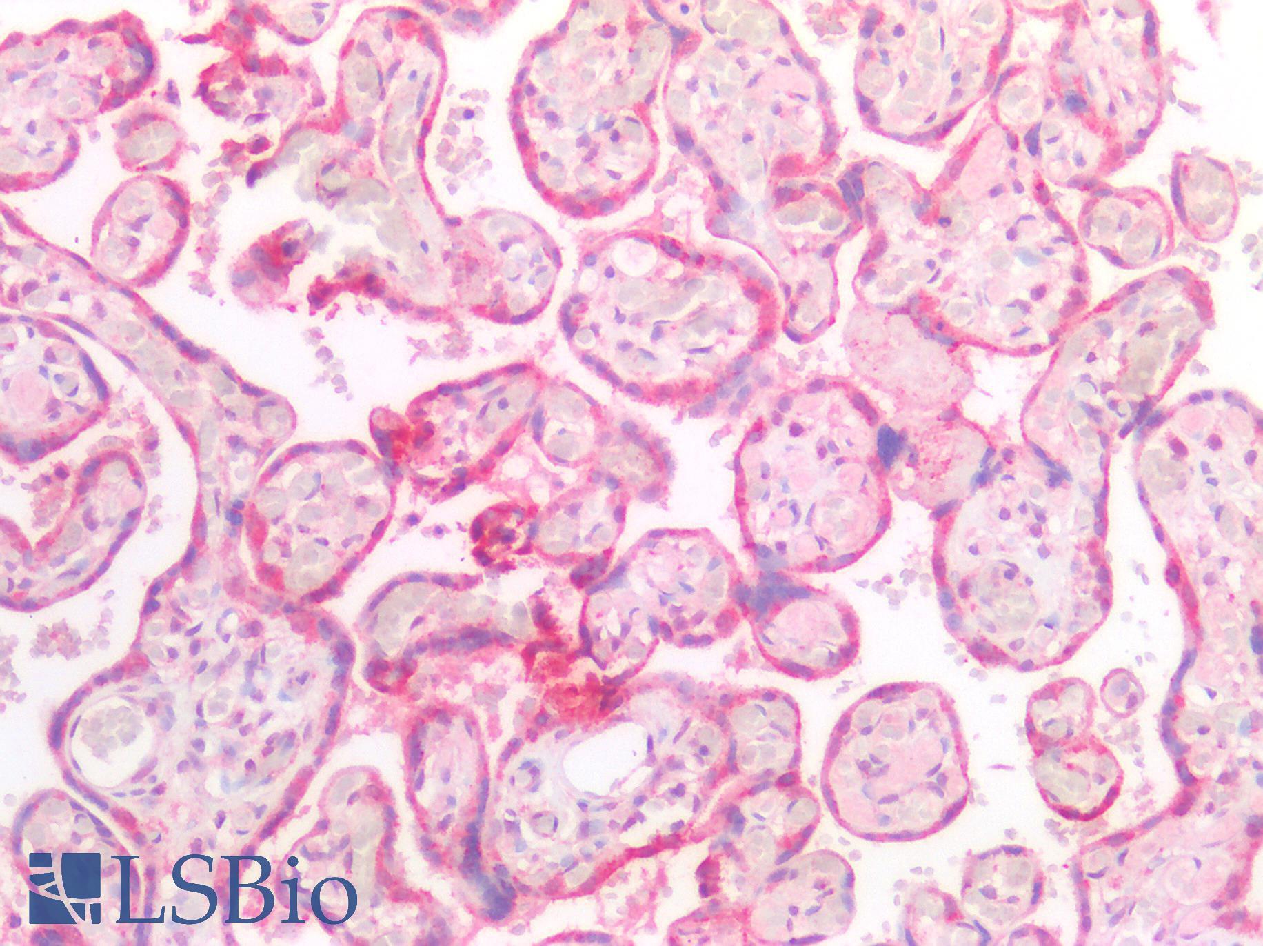 CTSK / Cathepsin K Antibody - Human Placenta: Formalin-Fixed, Paraffin-Embedded (FFPE)