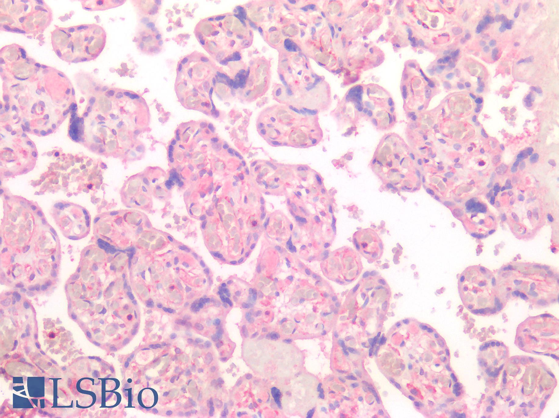 CTSK / Cathepsin K Antibody - Human Placenta: Formalin-Fixed, Paraffin-Embedded (FFPE)
