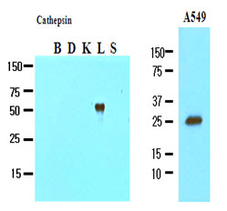 CTSL / Cathepsin L Antibody - The recombinant fusion proteins (Cathepsin B, D, K, L and S), and cell lysates of A549 (20 ug) were resolved by SDS-PAGE, transferred to NC membrane and probed with anti-human Cathepsin L (1:1000). Proteins were visualized using a goat anti-mouse secondary antibody conjugated to HRP and an ECL detection system.