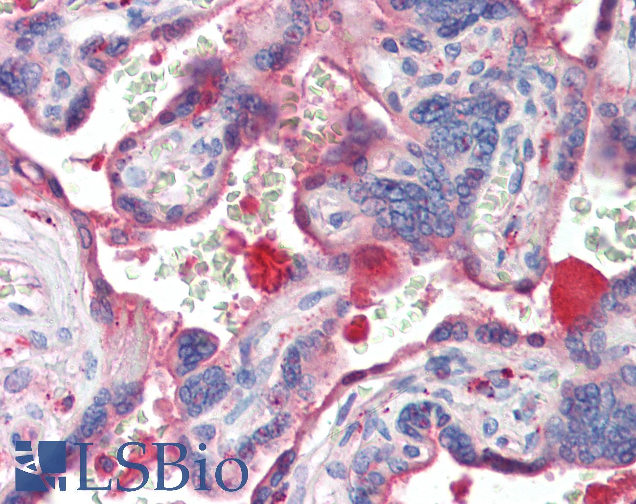 CTSL / Cathepsin L Antibody - Anti-CTSL1 / Cathepsin L antibody IHC of human placenta. Immunohistochemistry of formalin-fixed, paraffin-embedded tissue after heat-induced antigen retrieval. Antibody concentration 5 ug/ml.