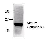 CTSL / Cathepsin L Antibody - Western blot of Cathepsin L with rat kidney tissue lysate