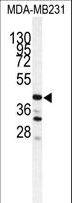 CTSS / Cathepsin S Antibody - Western blot of CTSS antibody in MDA-MB231 cell line lysates (35 ug/lane). CTSS (arrow) was detected using the purified antibody.