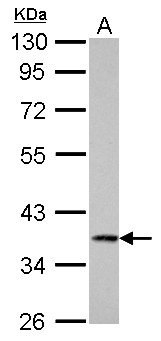 CTSS / Cathepsin S Antibody - Cathepsin S antibody detects CTSS protein by Western blot analysis. A. 30 ug HeLa whole cell lysate/extract. 10 % SDS-PAGE. Cathepsin S antibody dilution:1:1000