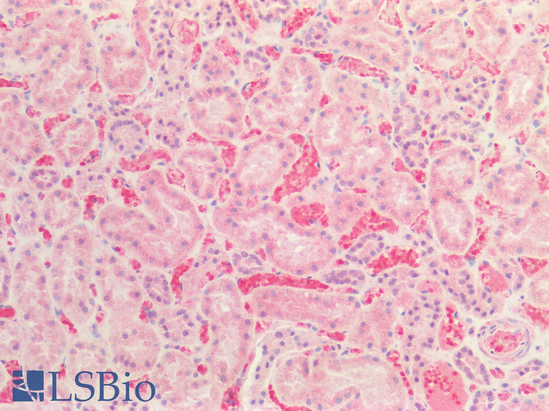 CTSS / Cathepsin S Antibody - Human Kidney: Formalin-Fixed, Paraffin-Embedded (FFPE)
