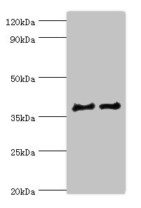CTSV / Cathepsin V Antibody - Western blot All lanes: CTSV antibody at 12µg/ml Lane 1: Jurkat whole cell lysate Lane 2: MCF-7 whole cell lysate Secondary Goat polyclonal to rabbit IgG at 1/10000 dilution Predicted band size: 37 kDa Observed band size: 37 kDa