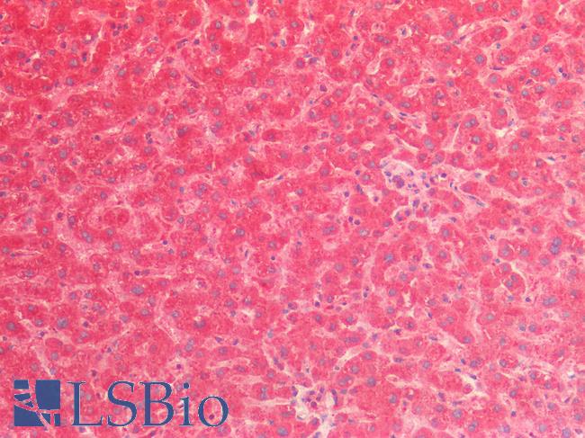 CTSV / Cathepsin V Antibody - Human Liver: Formalin-Fixed, Paraffin-Embedded (FFPE)