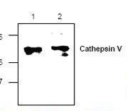CTSV / Cathepsin V Antibody - Western blot of CTSL2 / Cathepsin V antibody in Jurkat cell lysate (Lane 1) and mouse small intestine lysate (Lane 2).
