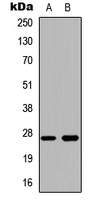 CTSZ / Cathepsin Z Antibody - Western blot analysis of Cathepsin Z expression in HeLa (A); human liver (B) whole cell lysates.