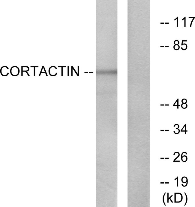 CTTN / Cortactin Antibody - Western blot analysis of lysates from HeLa cells, treated with H2O2, using Cortactin Antibody. The lane on the right is blocked with the synthesized peptide.