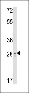 CUEDC2 Antibody - Western blot of CUEDC2 Antibody in Y79 cell line lysates (35 ug/lane). CUEDC2 (arrow) was detected using the purified antibody.