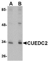 CUEDC2 Antibody - Western blot of CUEDC2 in HeLa cell lysate with CUEDC2 antibody at (A) 1 and (B) 2 ug/ml.