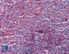 CUEDC2 Antibody - Anti-CUEDC2 antibody IHC of human spleen. Immunohistochemistry of formalin-fixed, paraffin-embedded tissue after heat-induced antigen retrieval. Antibody concentration 5 ug/ml.