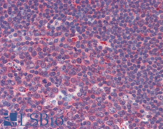 CUEDC2 Antibody - Anti-CUEDC2 antibody IHC of human tonsil. Immunohistochemistry of formalin-fixed, paraffin-embedded tissue after heat-induced antigen retrieval. Antibody concentration 5 ug/ml.