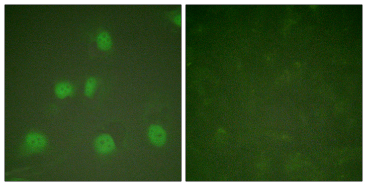 CUL1 / Cullin 1 Antibody - Immunofluorescence analysis of HeLa cells, using Cullin 1 Antibody. The picture on the right is blocked with the synthesized peptide.