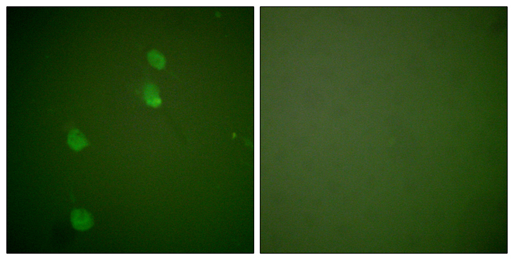 CUL2 / Cullin 2 Antibody - Immunofluorescence analysis of NIH/3T3 cells, using Cullin 2 Antibody. The picture on the right is blocked with the synthesized peptide.