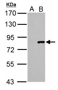 CUL3 / Cullin 3 Antibody - Cullin 3 antibody detects Cullin 3 protein by Western blot analysis. A. 30 ug 293T whole cell lysate/extract. B. 30 ug whole cell lysate/extract of human CUL3-transfected 293T cells. 7.5 % SDS-PAGE. Cullin 3 antibody dilution:1:5000