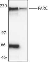 CUL9 / Cullin 9 Antibody - HepG2 cell extract (left lane) or NIH 3T3 cell extract (right lane) probed with monoclonal anti-PARC antibody. Proteins were visualized using a goat anti-mouse secondary conjugated to HRP and chemiluminescence. In all human cell lines tested, this antibody recognizes a non-specific 66 kD protein in addition to PARC.