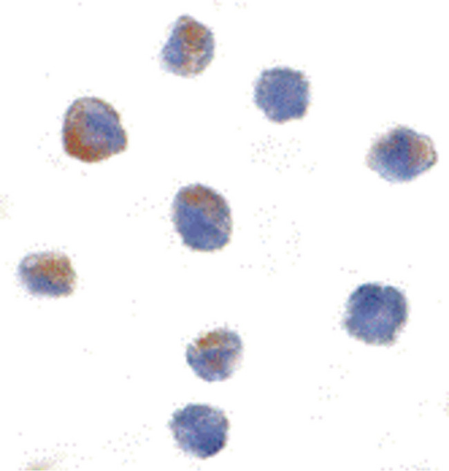CUL9 / Cullin 9 Antibody - Immunocytochemistry of Parc in Daudi cells with Parc antibody at 1 ug/ml.