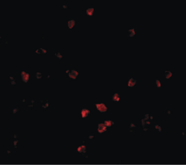CUL9 / Cullin 9 Antibody - Immunofluorescence of Bcl-G in Daudi cells with Bcl-G antibody at 2 ug/ml.