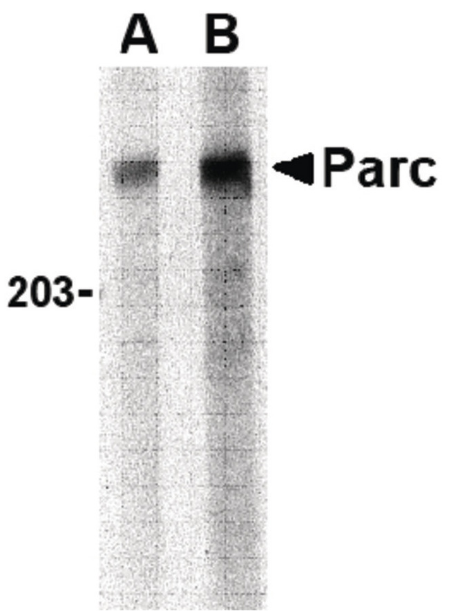 CUL9 / Cullin 9 Antibody - Western blot of PARC in Daudi lysate with PARC antibody at (A) 1 and (B) 2 ug/ml.