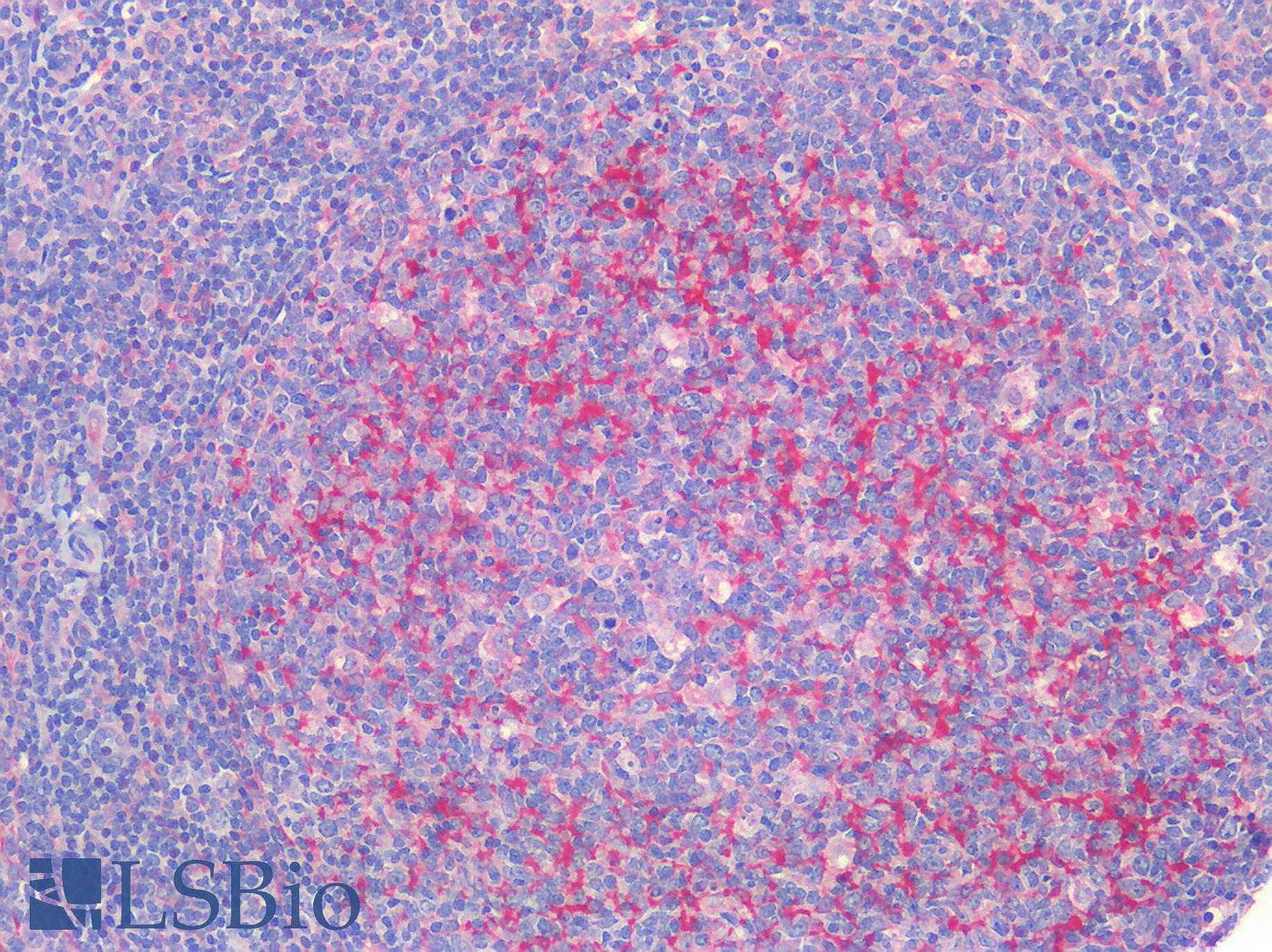 CX3CL1 / Fractalkine Antibody - Human Tonsil: Formalin-Fixed, Paraffin-Embedded (FFPE)