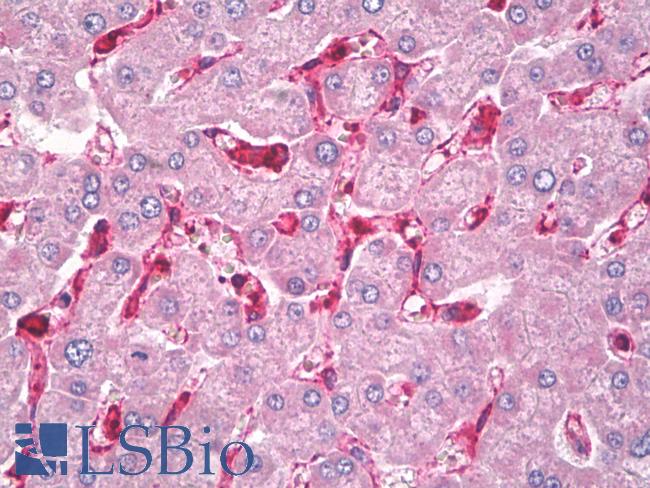 CXCL11 Antibody - Anti-CXCL11 antibody IHC of human liver, Kupffer cells. Immunohistochemistry of formalin-fixed, paraffin-embedded tissue after heat-induced antigen retrieval. Antibody dilution 5 ug/ml.