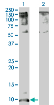 CXCL5 Antibody - Western blot of CXCL5 expression in transfected 293T cell line by CXCL5 monoclonal antibody clone 2A9.
