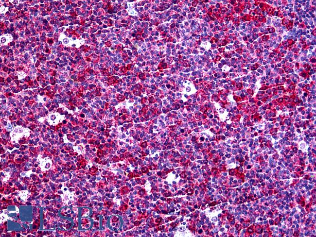 CXCL5 Antibody - Anti-CXCL5 antibody IHC of human tonsil. Immunohistochemistry of formalin-fixed, paraffin-embedded tissue after heat-induced antigen retrieval. Antibody concentration 5 ug/ml.