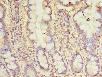 CXCL6 Antibody - Immunohistochemistry of paraffin-embedded human small intestine tissue using antibody at dilution of 1:100.