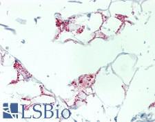 CXCL6 Antibody - Human Pancreas, Adipocytes: Formalin-Fixed, Paraffin-Embedded (FFPE), at a concentration of 10 ug/ml. 