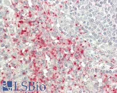 CXCL7 / PPBP Antibody - Human Spleen: Formalin-Fixed, Paraffin-Embedded (FFPE)