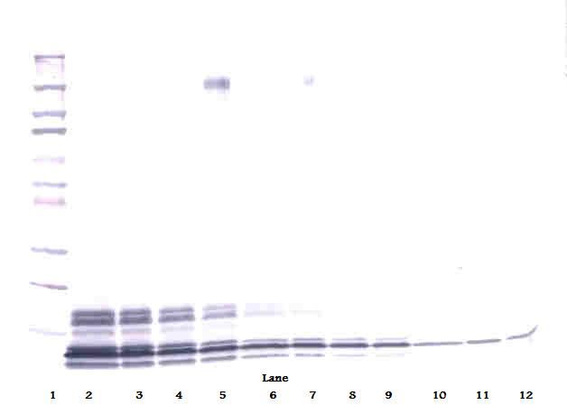 CXCL7 / PPBP Antibody - Western Blot of PPBP / CXCL7 antibody
