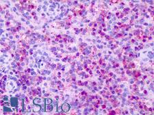 CXCR1 Antibody - Anti-CXCR1 antibody IHC of human spleen, neutrophils. Immunohistochemistry of formalin-fixed, paraffin-embedded tissue after heat-induced antigen retrieval. Antibody dilution 16 ug/ml.