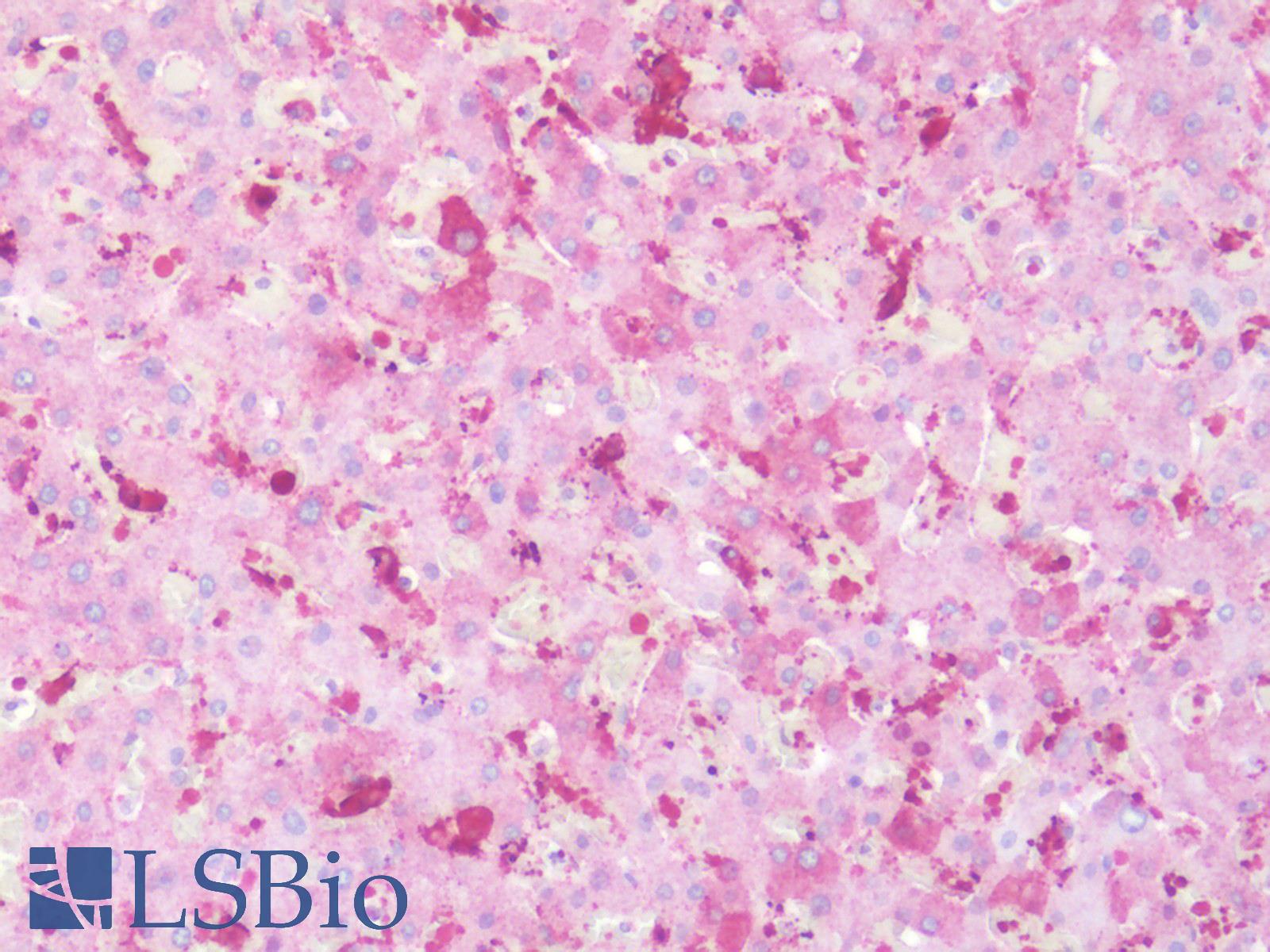 CXCR1 Antibody - Human Liver, Macrophages: Formalin-Fixed, Paraffin-Embedded (FFPE)