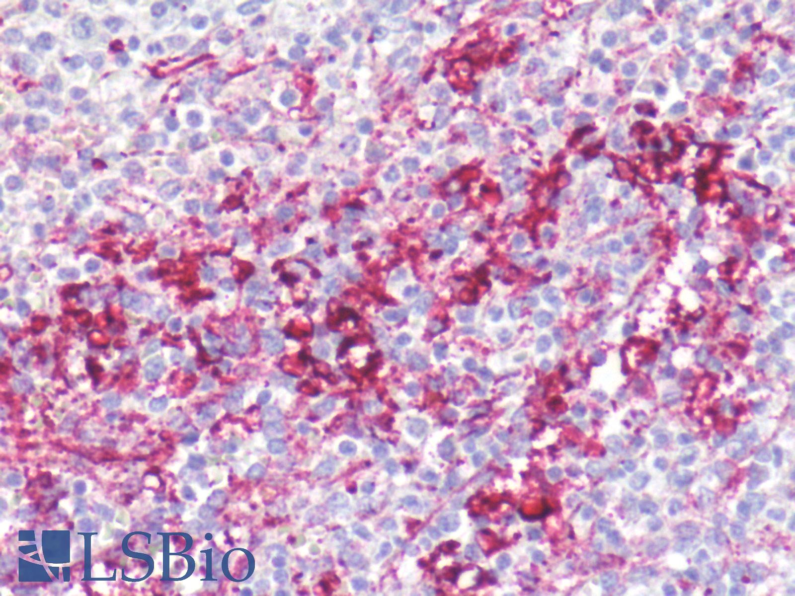 CXCR1 Antibody - Human Spleen, Neutrophils: Formalin-Fixed, Paraffin-Embedded (FFPE)