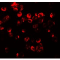 CXCR3 Antibody - Immunofluorescence of CXCR3 in HepG2 cells with CXCR3 antibody at 20 µg/mL.