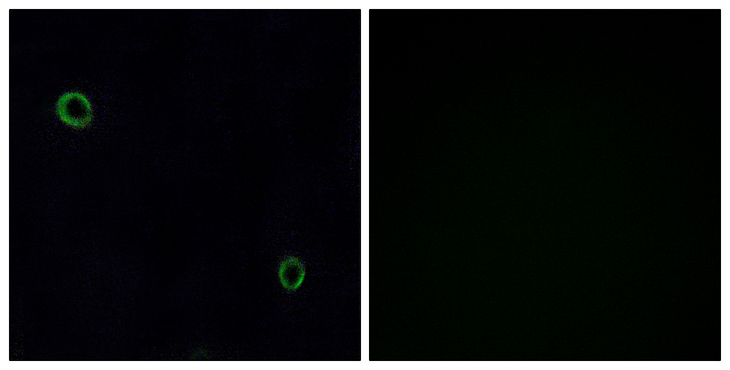 CXCR4 Antibody - Immunofluorescence analysis of A549 cells, using CXCR4 Antibody. The picture on the right is blocked with the synthesized peptide.