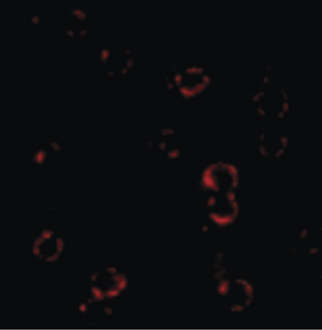 CXCR4 Antibody - Immunofluorescence of CXCR4 in cells with CXCR4 antibody.