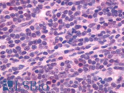 CXCR5 Antibody - Lymph node, Mantle Cell lymphoma