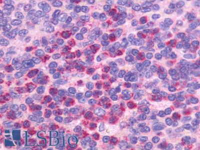 CXCR5 Antibody - Spleen, Chronic Lymphocytic leukemia