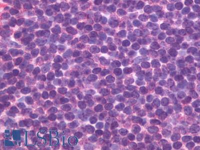 CXCR5 Antibody - Lymphoid Follicle