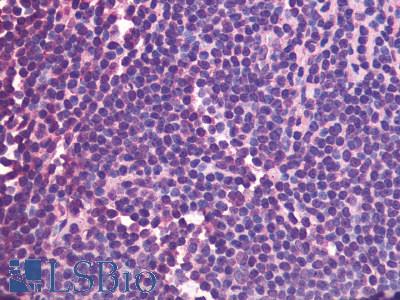 CXCR5 Antibody - Lymph node, Mantle Cell lymphoma