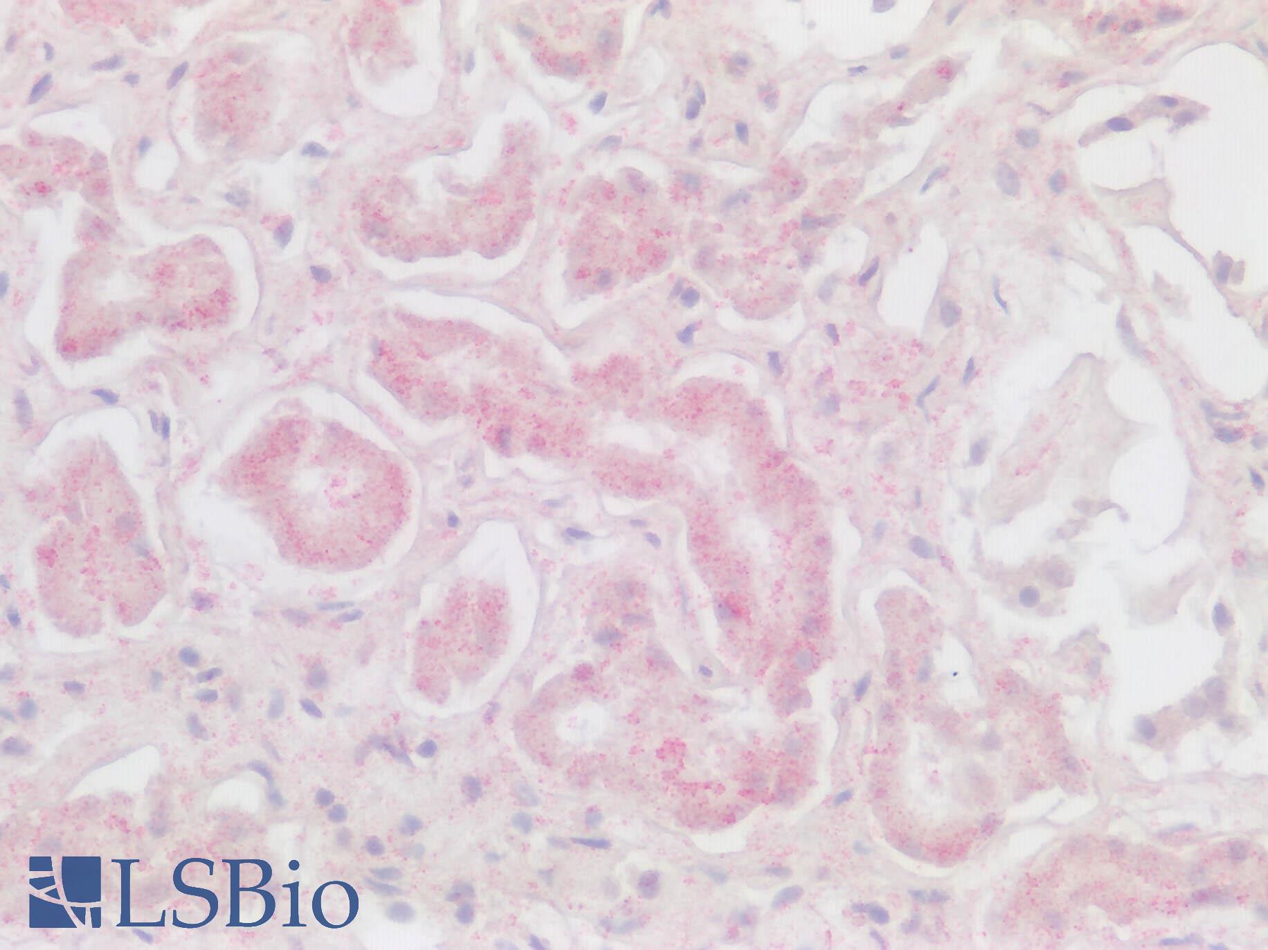 CXCR6 Antibody - Human Kidney: Formalin-Fixed, Paraffin-Embedded (FFPE)