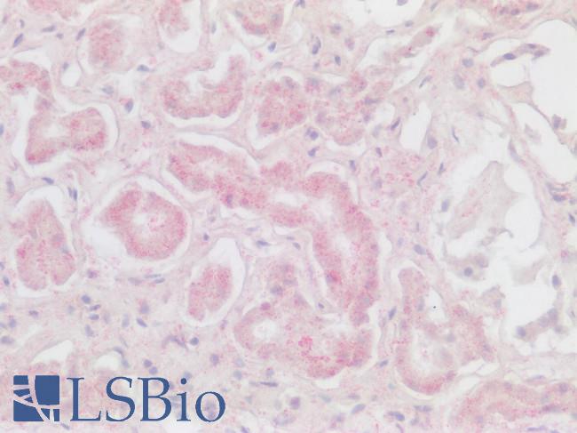 CXCR6 Antibody - Human Kidney: Formalin-Fixed, Paraffin-Embedded (FFPE)