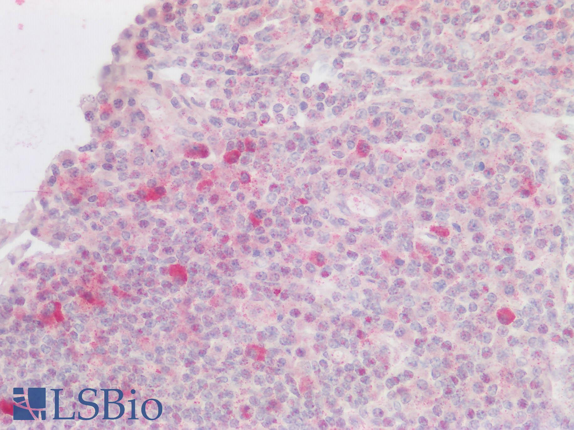 CXCR6 Antibody - Human Lymph Node: Formalin-Fixed, Paraffin-Embedded (FFPE)