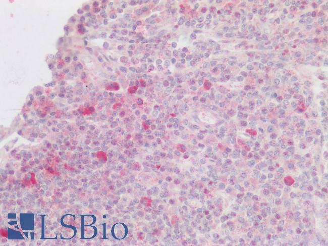 CXCR6 Antibody - Human Lymph Node: Formalin-Fixed, Paraffin-Embedded (FFPE)