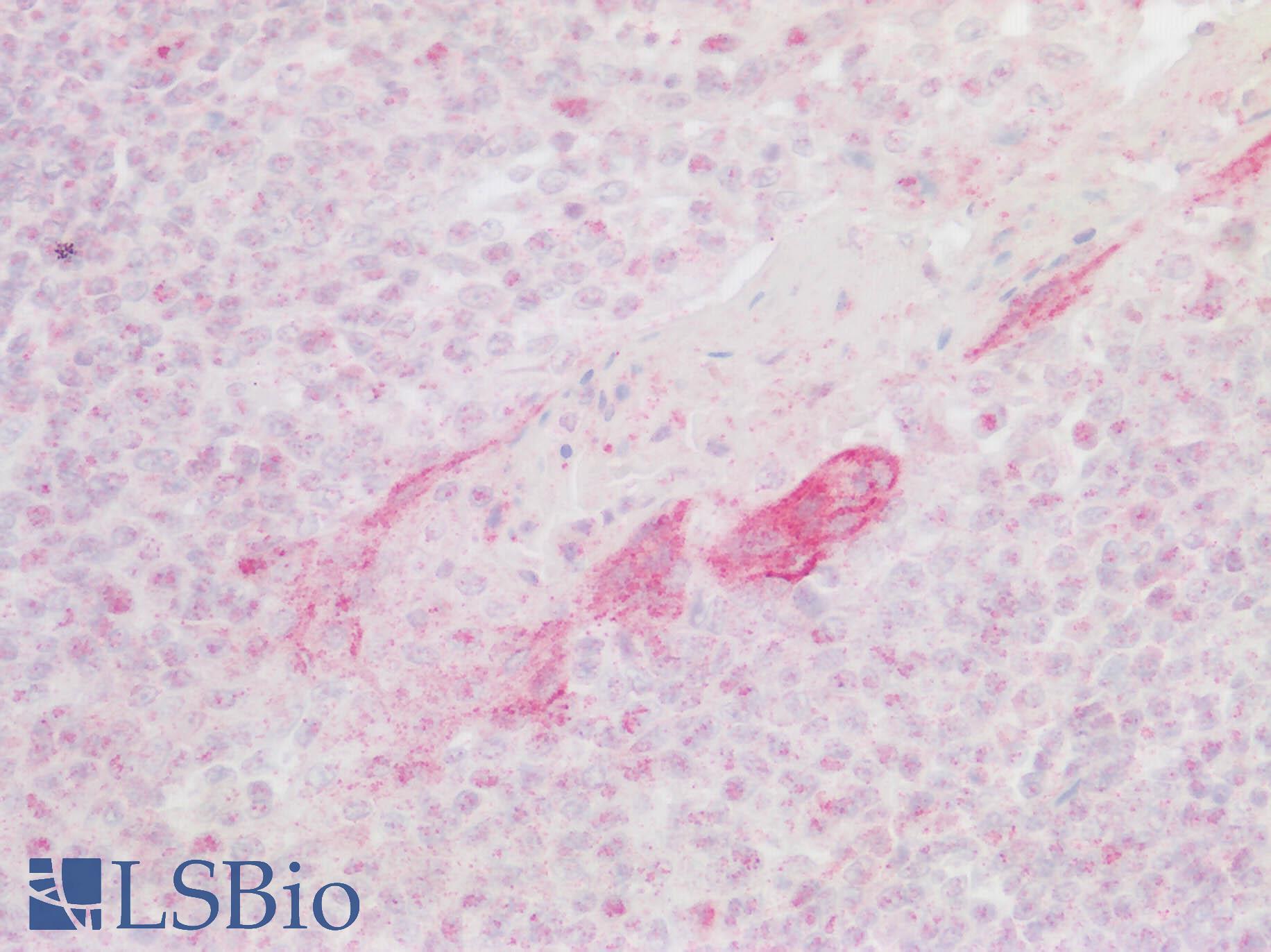 CXCR6 Antibody - Human Tonsil: Formalin-Fixed, Paraffin-Embedded (FFPE)