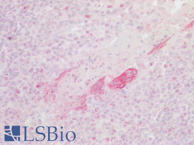 CXCR6 Antibody - Human Tonsil: Formalin-Fixed, Paraffin-Embedded (FFPE)