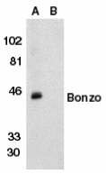 CXCR6 Antibody - Western blot of Bonzo in human spleen tissue lysate in the absence (lane A) or presence (lane B) of peptide with Bonzo antibody at 1 ug/ml.